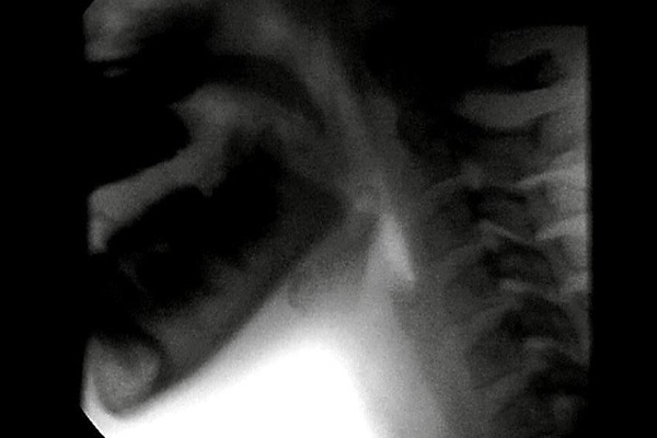 xray image