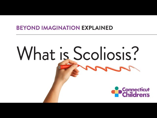 What is Scoliosis?