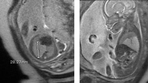 MRI Image