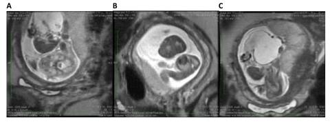 A MRI image