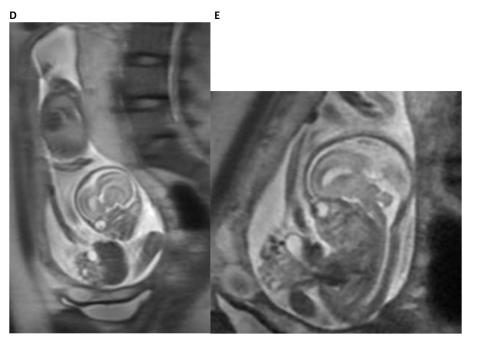 A MRI image